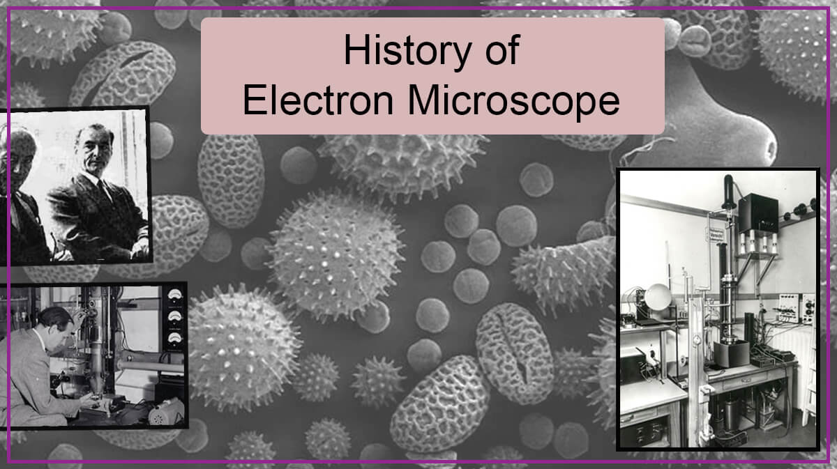 History of Electron Microscope : Invention and Development